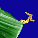 图像显示显微镜中某些沾染(可能是单差多苯球从前用户收集),该显微镜碰巧收集到Ta2O5粒子角