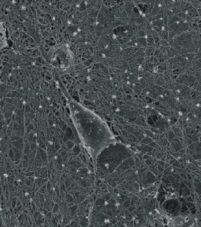 SEM显微图显示培养鼠河马神经元生长层净化碳纳米管